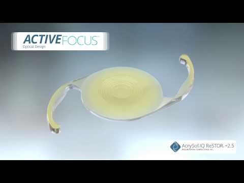 Alcon Activefocus Restor 2.5 Multifocal Intraocular Lens