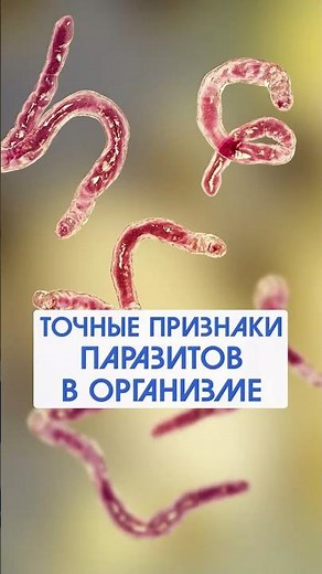 What are the actual symptoms of parasites? #vasilykorolishin #health #parasites