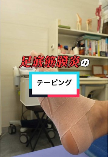 足底筋膜炎のテーピングをご紹介します！ぜひ参考にしてみてください🔥 #足底筋膜炎#テーピング #テーピングの巻き方 #宮崎