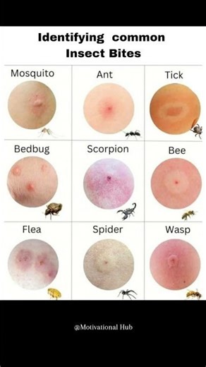 Identifying common Insect Bites