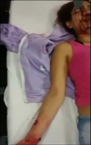 Girl with knife stabbed on her face