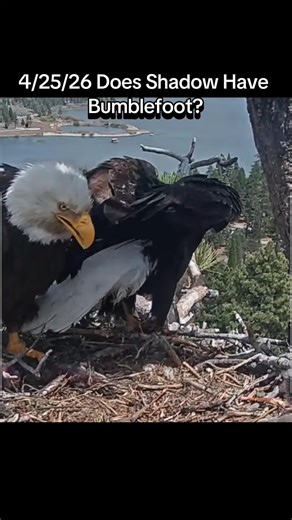 I'm no expert, but Shadow's injured foot looks to be healing well ❤️ And making this video put my mind at ease, hope it did for all of you as well 🤗 ❤️ Footage courtesy of FOBBV Friends of Big Bear Valley #shadowandjackie #wildlife #baldeagle #raptor #bigbearvalley