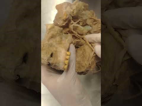 Triangulos del cuello