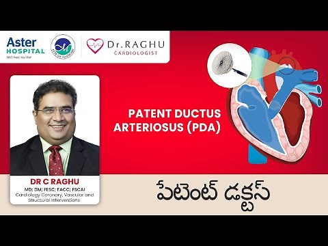 What is PDA | PDA Closure | Device Closure Vs Surgical Ligation | Risks & Facts of PDA Closure