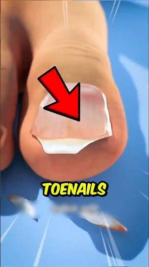 If You Ever Cut Your Toenails Like This, STOP Immediately!