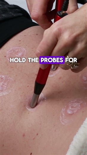 Understanding the Gain Spectrum: How the Electro-Equiscope® Listens to Tissue Feedback