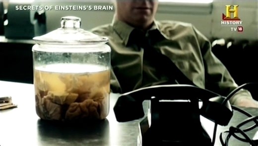 Secrets Of Einstein's Brain (History Channel Documentary)