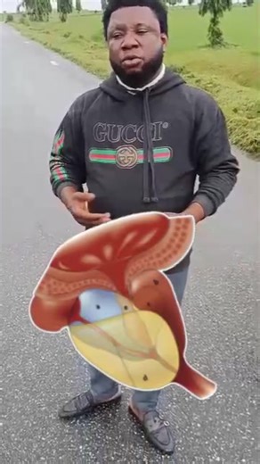 Understanding Prostate Health Prostate health is an essential aspect of men's overall well-being. The prostate gland plays a crucial role in the male reproductive system, and issues can arise as men age. Common Prostate Issues 1. Benign Prostatic Hyperplasia (BPH): Enlargement of the prostate gland, which can cause urinary symptoms. 2. Prostate Cancer: Abnormal cell growth in the prostate gland, which can be life-threatening if left untreated. Symptoms to Watch Out For 1. Urinary issues Difficul