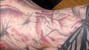 Study: Tattoo infections traced to tainted ink