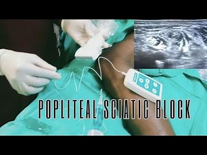 Popliteal sciatic block