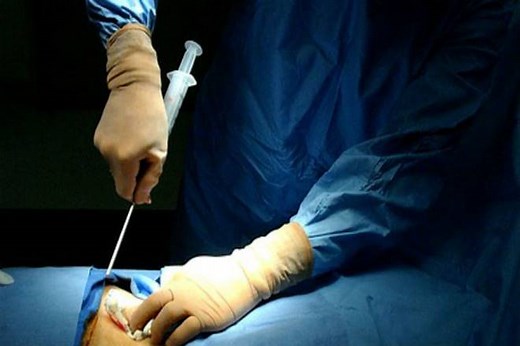 How LifeCell became the most accredited stem cell bank in India