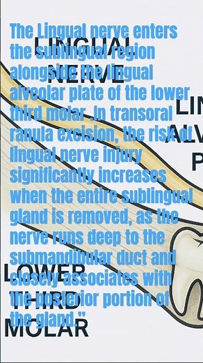 LINGUAL NERVE//SUBLINGUAL GLAND EXCISION//RANULA SURGERY