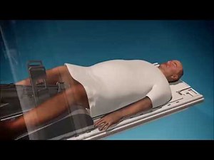 Novel MRI-Guided Ultrasound Treatment Destroys Prostate Cancer