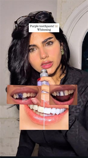 Mery Nobart on Instagram: "Purple toothpaste for whitening 🦷 ?? #dentist #purpletoothpaste #teeth"