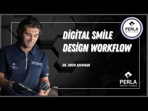 Digital Smile Design Workflow Explained | 5–7 Days Treatment Process