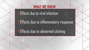 Latest updates on COVID-19: April 20, 2020