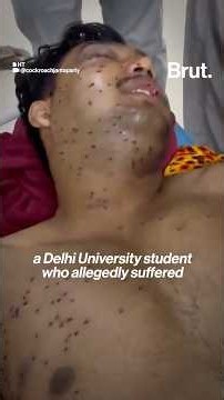Can dissent be met with pellet guns?