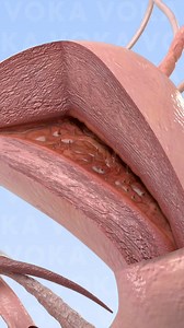 1.5M views · 7K reactions | Tuberculous endometritis, a rare yet...