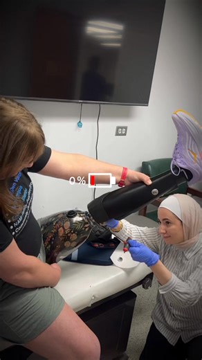 🦿 Dynamic Alignment in Progress Our team is performing dynamic alignment for a transfemoral prosthesis, ensuring the perfect balance between comfort, function, and stability. This crucial step helps fine-tune the prosthesis so every step feels smooth, natural, and efficient. #ProstheticAlignment #QuantumPO #PrecisionAndCare #ProstheticsThatInspire #QuantumPO #UpperLimbProsthetics #Teamwork #PositiveMindset #NoLimits #ProstheticsThatInspire #QuantumPO #PatientInspiration #everyonehighlightsfollo