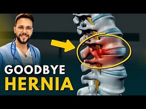 The Best Exercise for SCIATIC PAIN and HERNIATED DISC - McKenzie