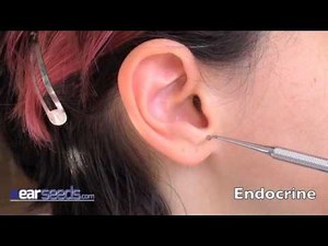 Endocrine Auriculotherapy Ear Point