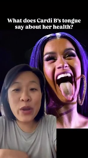 11K views · 14 comments |  TCM tongue reading FLASH sale: comment “tongue reading” below to get a personalized $99 tongue reading (normally $149!) The tongue is a main indicator in Chinese Medicine to get to the root cause of your symptoms. We treat chronic illnesses by getting to the root of your problem. If you’ve been looking for answers into your health, then this is a great way to get started. #tonguereading #chinesemedicine | KUN崑 | Facebook