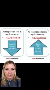 1K views · 23 reactions | When patients hyperventilate (pain,...