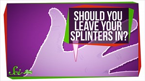 How Your Immune System Reacts to a Splinter | Videos