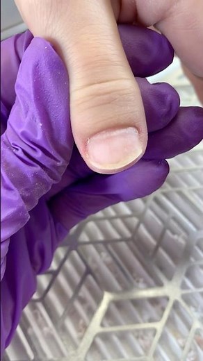 How to fix wide thumb ? 🤨 #nails
