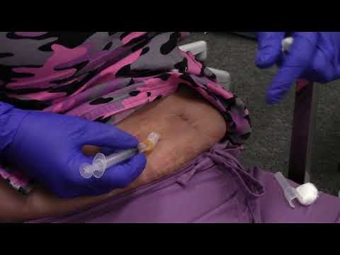 Injection subcutaneous in abdomen on self skills training