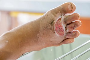 What Does an Infected Cut Look Like? Signs, Symptoms, and When to Seek Medical Attention