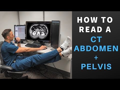 Radiology: How to Read a CT Abdomen & Pelvis (My search pattern)