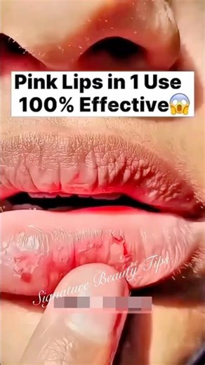 Get Pink & Soft Lips NaturallyDark Lips To Baby Pink Lips at Home #lips #lipcare #foryou #diy