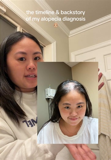Understanding My Alopecia Diagnosis Timeline