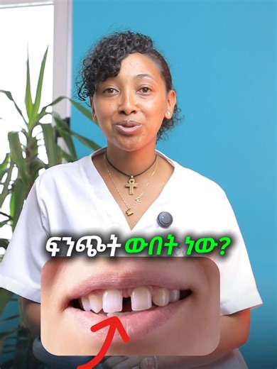 gapped teeth filling 1500etb #artificialteeth #compositefilling #gappedteeth #filling