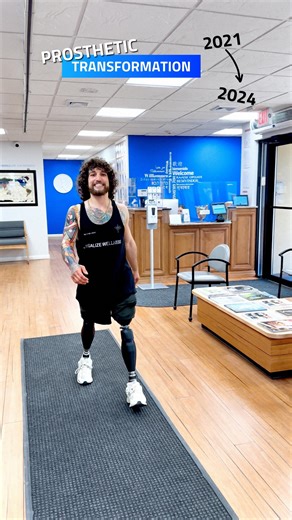 🚨Prosthetic Transformation🚨 Nick, a bilateral AK amputee, whose journey since 2021 has been nothing short of inspiring. From his first visit to now, Nick has shown remarkable control and confidence with his prosthetics. His prostheses have truly become an extension of his body, enabling him to live life to the fullest!?🦿🦾 What do you think of this Progress?! #transformationthursday #prostheticprogress #abovekneeamputee #adaptive | A Step Ahead Prosthetics