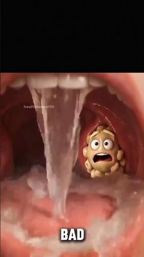 Salt Water Gargle Hack 🧂💧 Keeps Tonsil Stones Away Fast Naturally #shorts