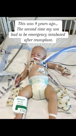 15K views · 1.1K reactions | 9 years ago…Grayson was intubated and in...