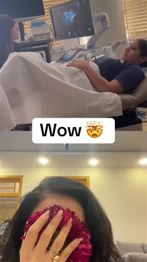 Triplet Ultrasound: Mom Shares Amazing Moment