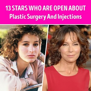 535K views · 996 reactions | 13 Stars Who Are Open About Plastic Surgery And Injections | CelebRatings | Facebook