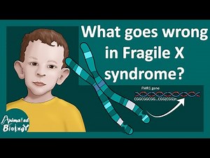 Fragile X mental retardation syndrome| Fragile X intelligence & behavior issues | FMR1 gene mutation