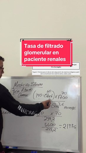 Cómo calcular la tasa de filtrado glomerular en pacientes renales