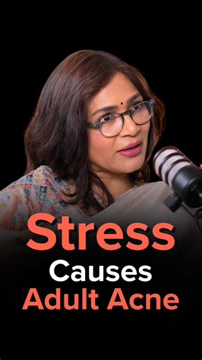 Stress Causes Adult Acne
