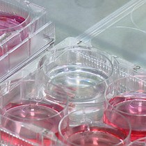 Video: A RANKL-based Osteoclast Culture Assay of Mouse Bone Marrow to Investigate the Role of mTORC1 in Osteoclast Formation