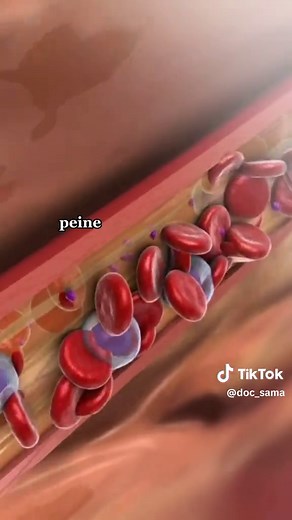 Hypercalcémie et son impact sur le cœur et le système nerveux
