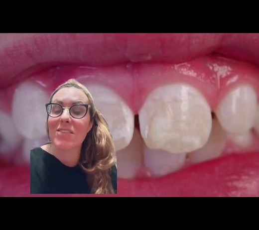Managing Oral Health for Celiac Patients