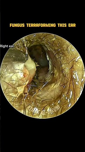 FUNGUS TERRAFORMING THIS EAR