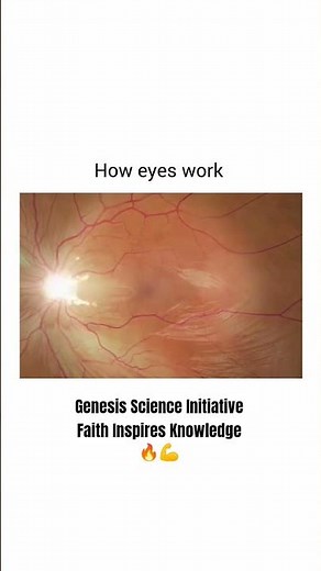 How the Human Eye Works... #howitworks #scienceexplained #eyes
