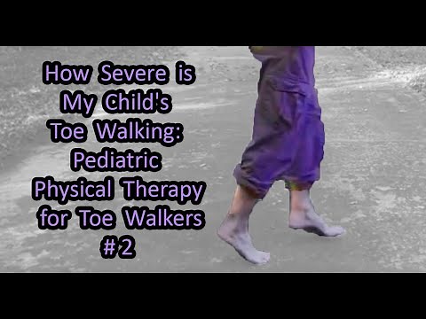 # 2 How Severe is My Child's Toe Walking: Pediatric Physical Therapy for Toe Walkers