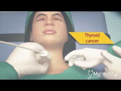 How does the thyroid work? - YMyHealth